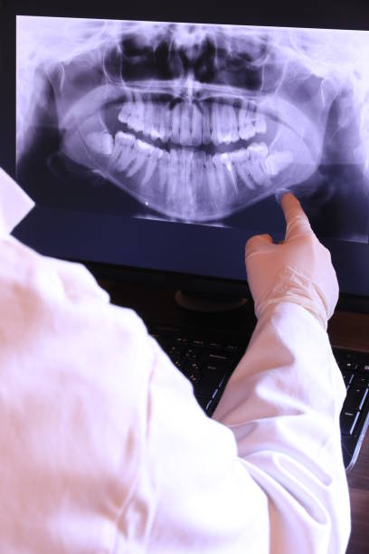 Best Emergency Wisdom Tooth Extraction in New Milford, NJ