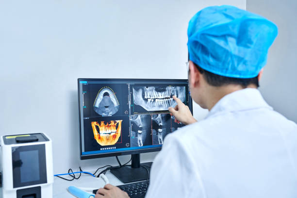Best Dental Abscess Treatment in New Milford, NJ
